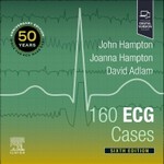 160 ECG Cases 6th Ed 2024